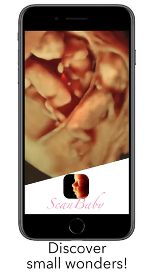 ScanBaby 学习婴儿超声